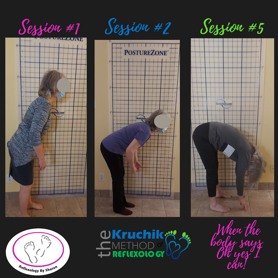 This woman couldn't bend over but now she can after 5 sessions