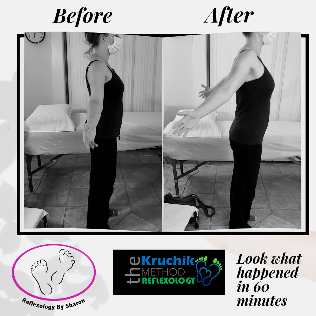 This woman couldn't strech her arms behind her back but now she can after 1 session