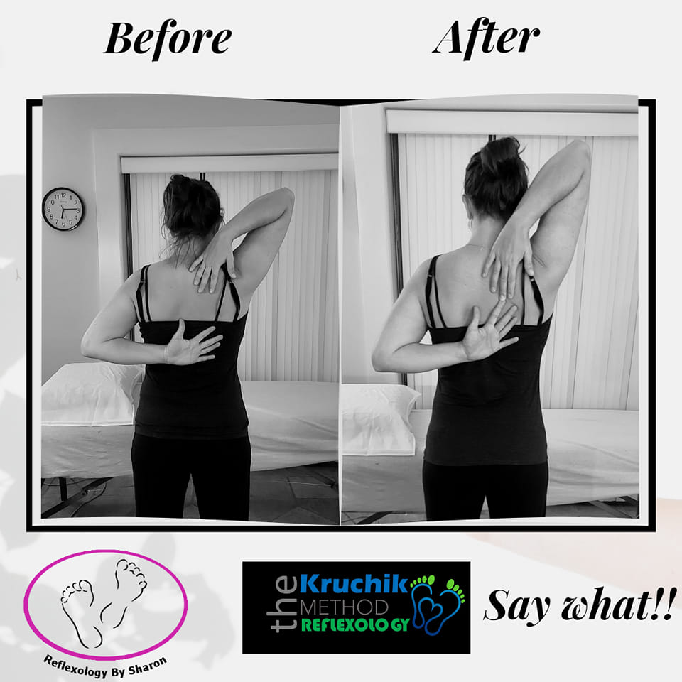 This woman couldn't touch her hands behind her back but now she can